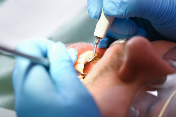 Best Emergency Tooth Extraction in Ellettsville, IN